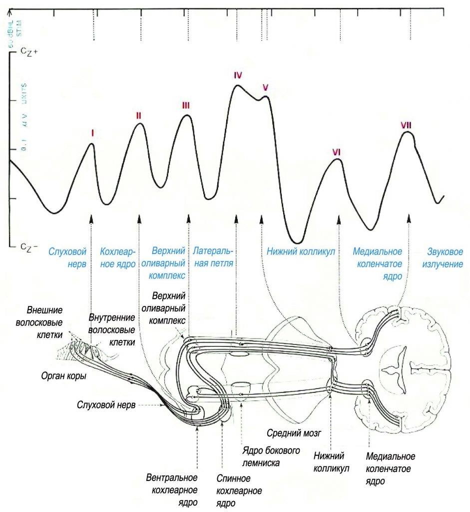 sluh-3